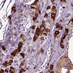 Secretogranin V Antibody, Novus Biologicals 25 &mu;L; Unlabeled:Antibodies,